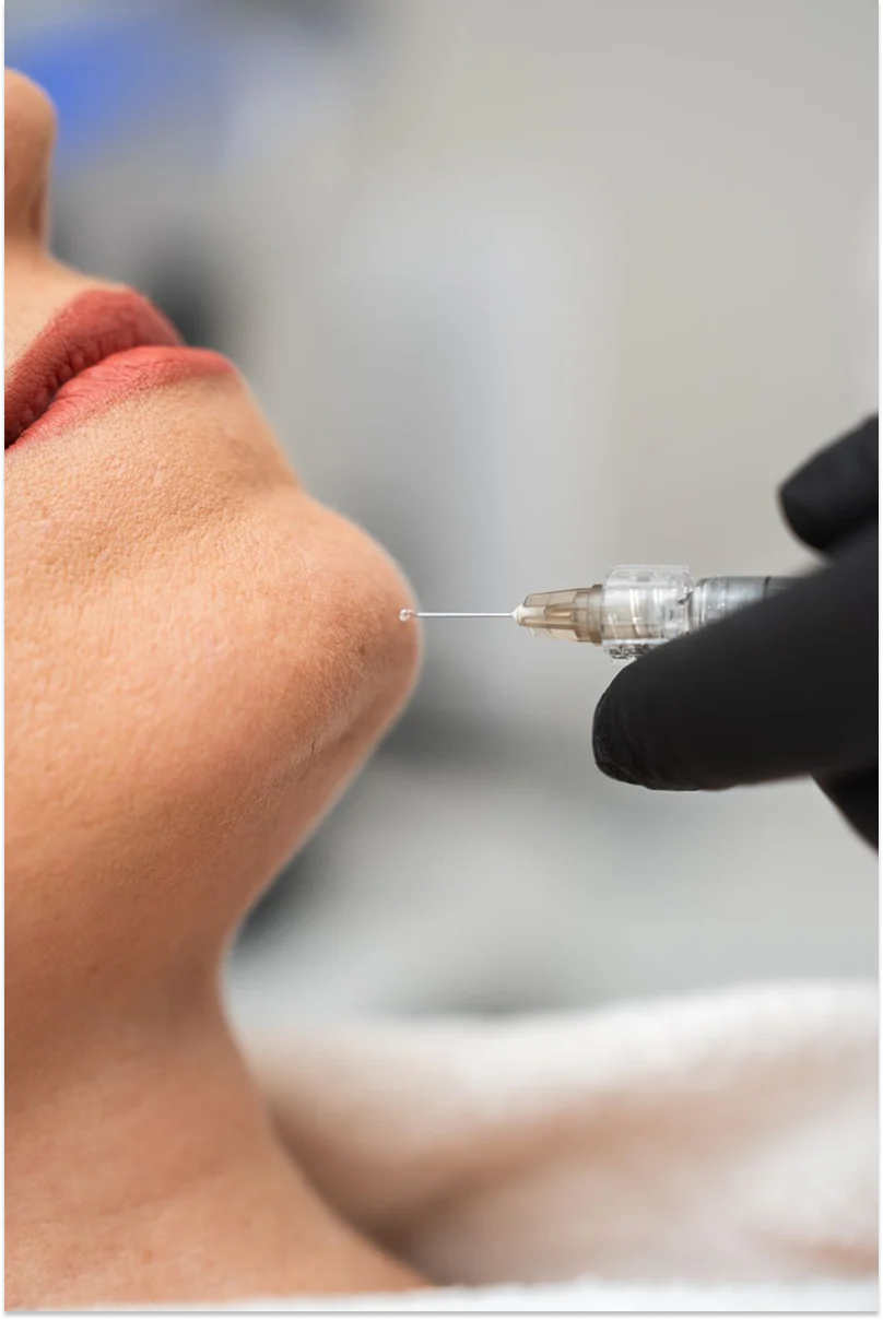 What Are the Do's and Don'ts of Kybella