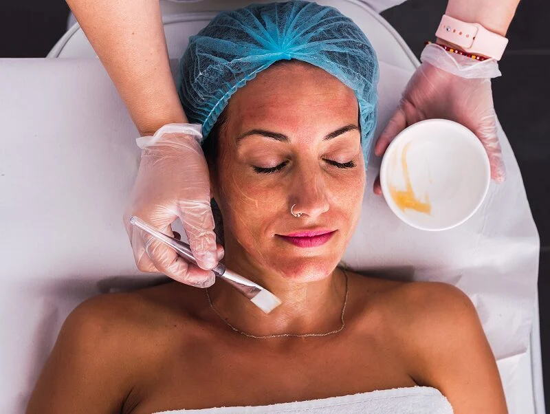Laser Treatment For Hyperpigmentation Orinda