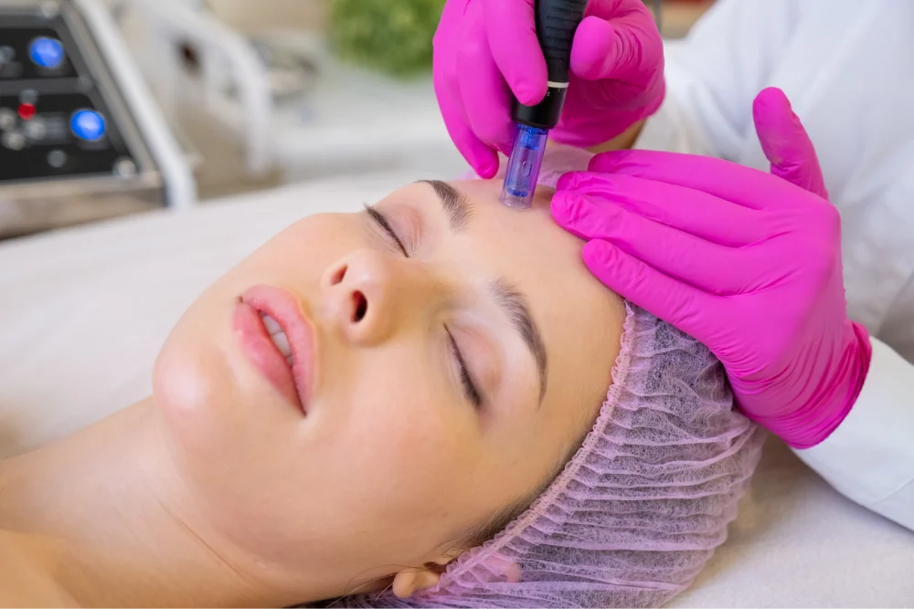 Acne Scar Treatment Skin Artistry Clinic