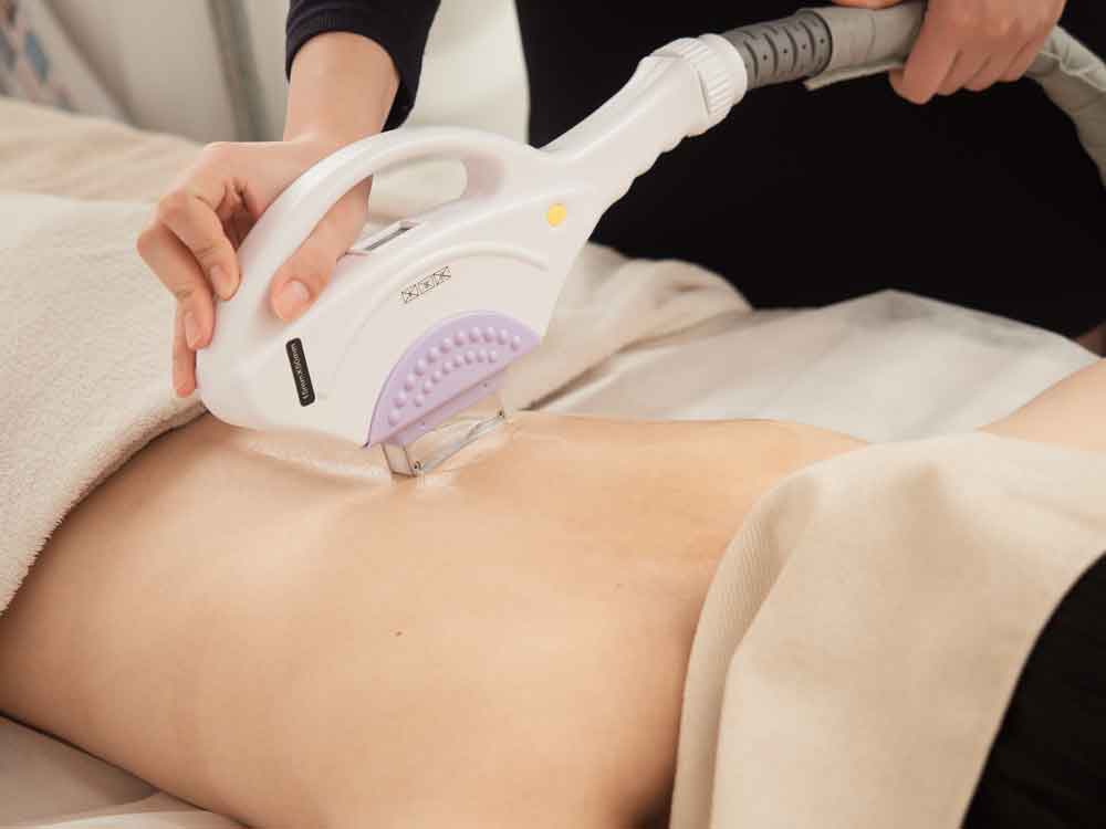 Can You Combine IPL & Microneedling?