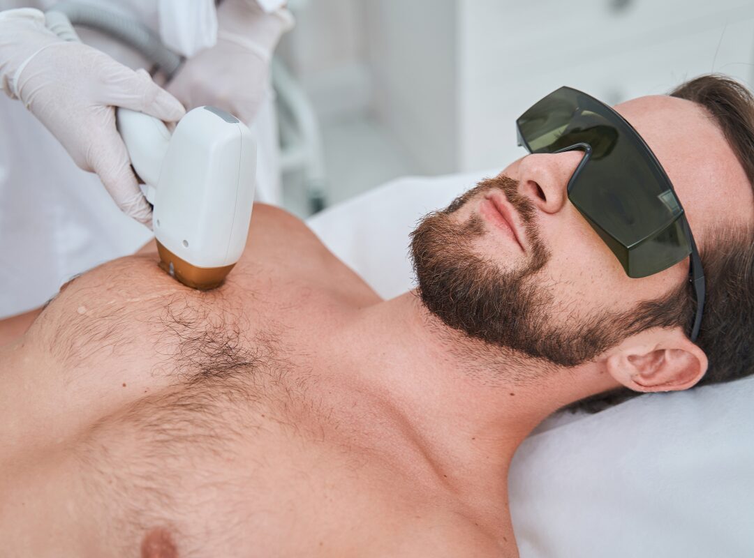 Medical-grade Peels in Tracy CA