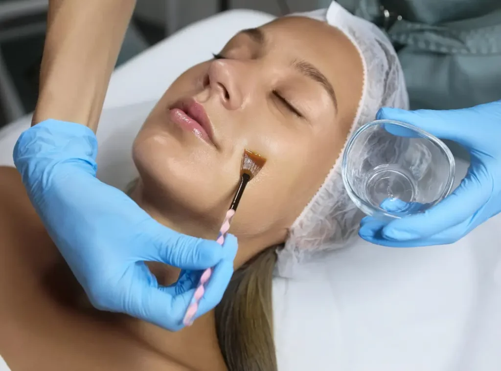 Chemical Peel Near Me