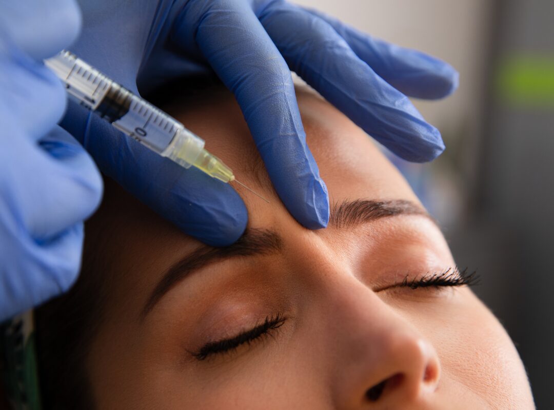 Tracy California Microneedling Clinic