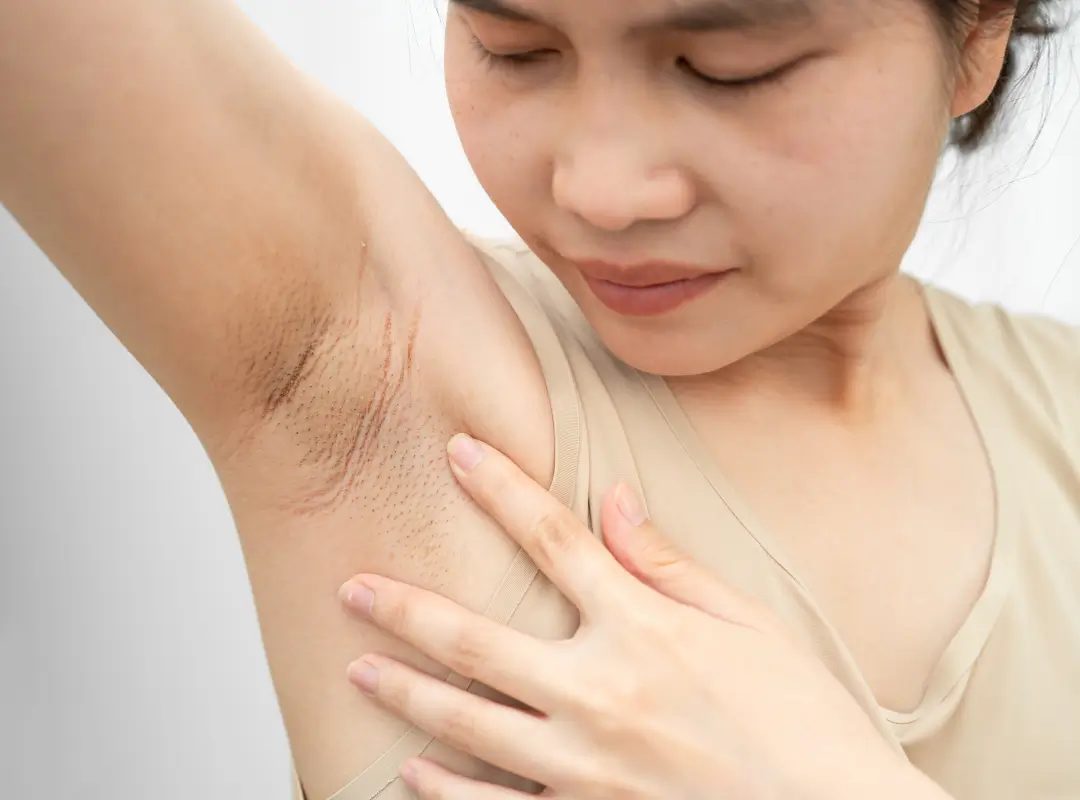 Can Underarm Darkness Go Away