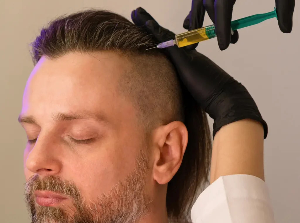PRP Hair Treatment for Thinning Hair