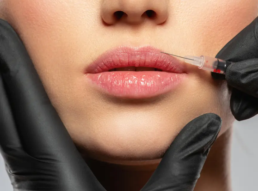 Botox, Fillers & Facials in Danville