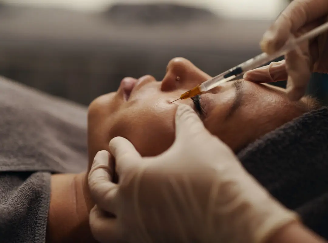Under Eye Fillers Skin Artistry Clinic