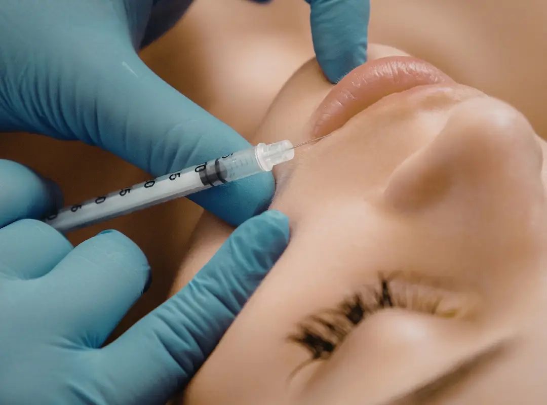 Acne Scars Treatment Oakley