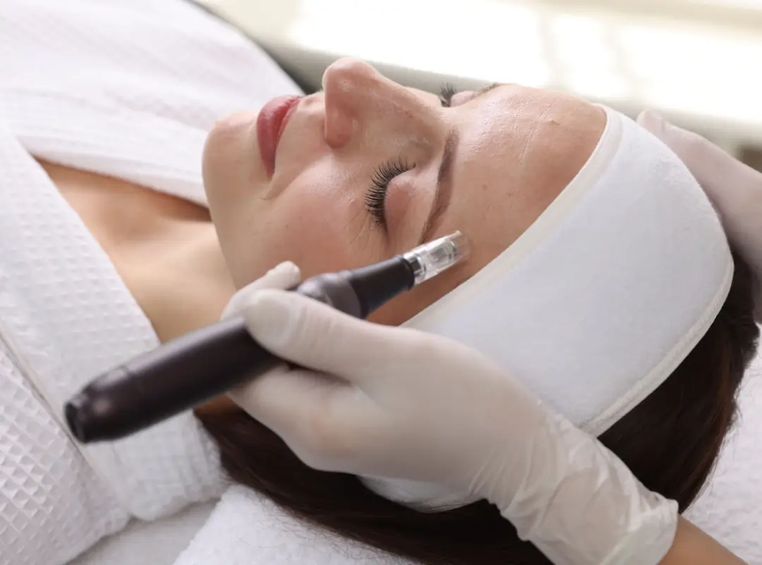 Microneedling Treatments Danville Walnut Creek