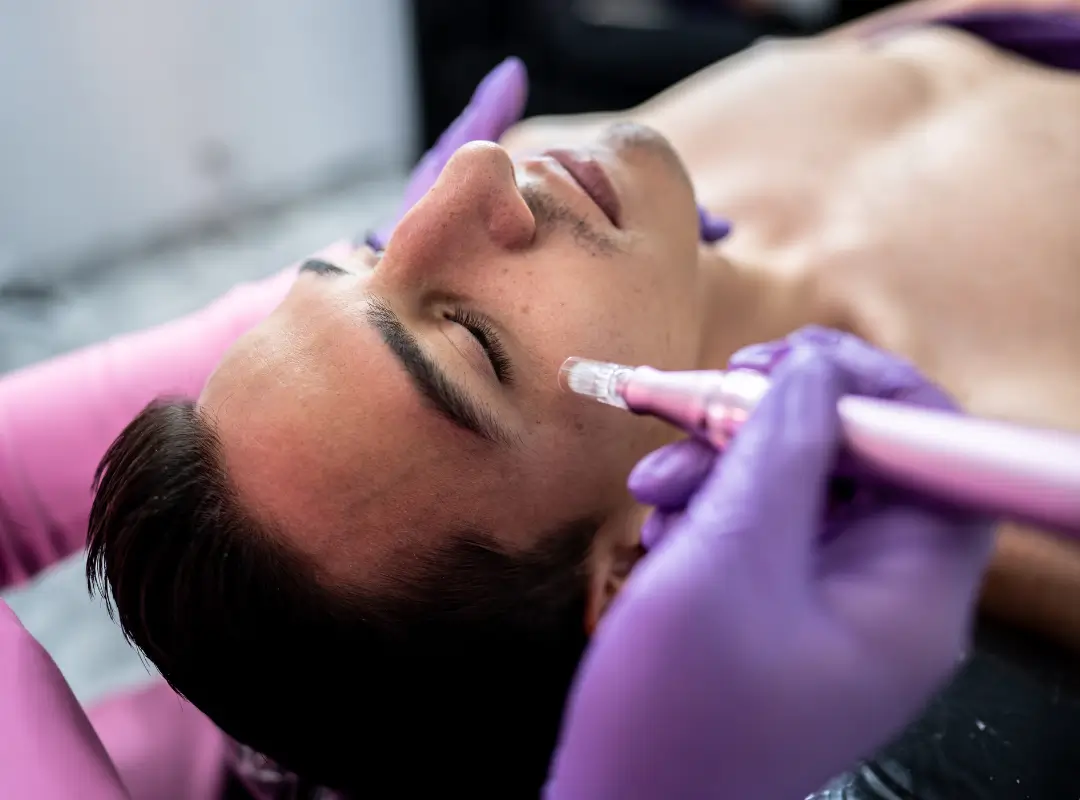 Average Cost Of Microneedling In Danville