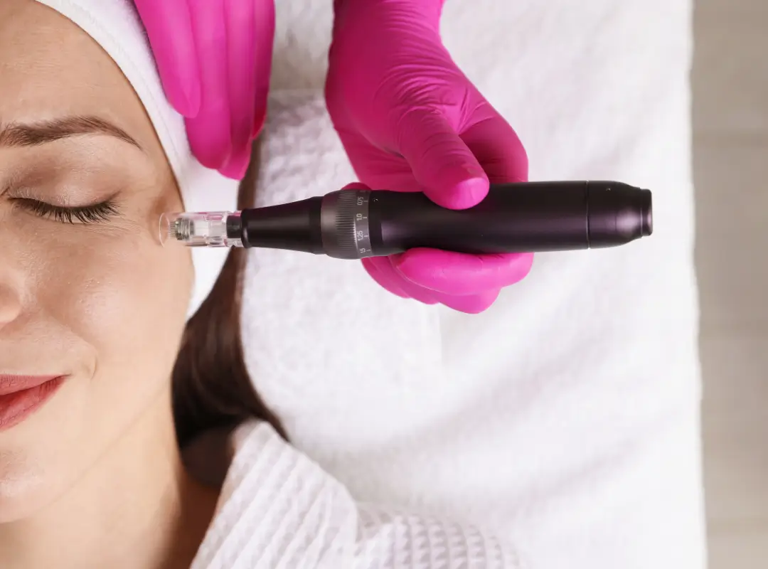 Best Microneedling In Danville
