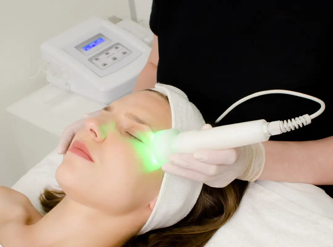 What Is The Downside Of IPL Treatment