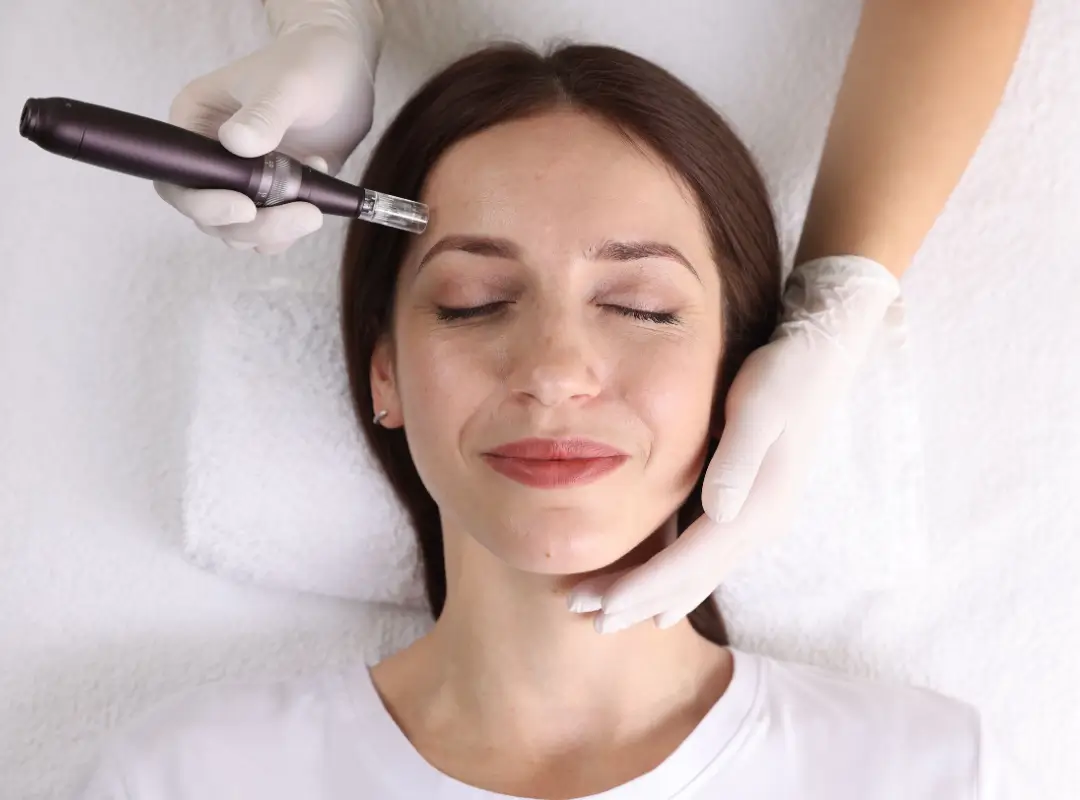Danville Microneedling Session By Skin Artistry Clinic