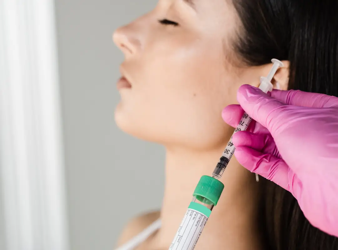 Alamo CA PRP Hair Treatment