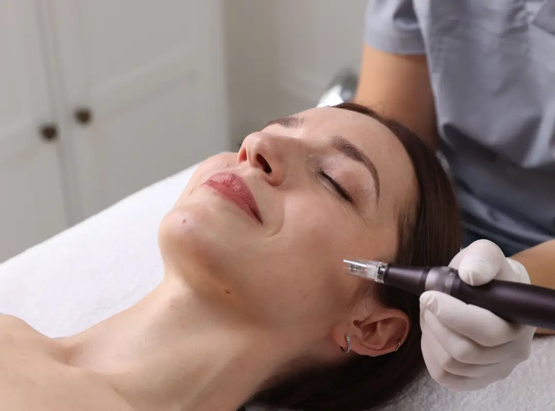 Skin Artistry Clinic Laser Treatment Oakley
