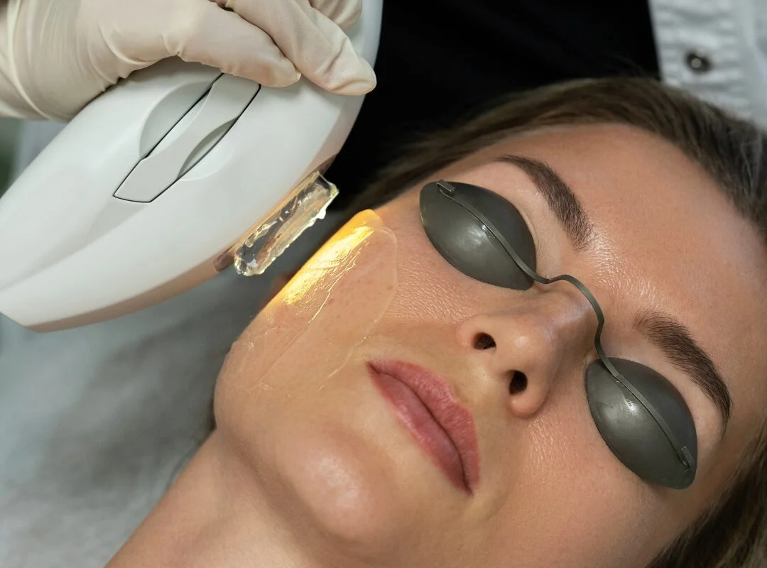 What Treatment Can I Combine With IPL
