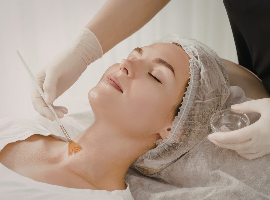 Should I Do IPL or Chemical Peel First