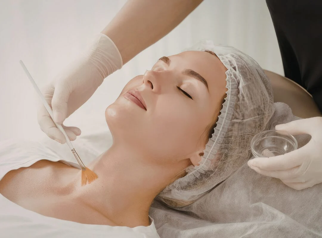 Should I Do IPL or Chemical Peel First