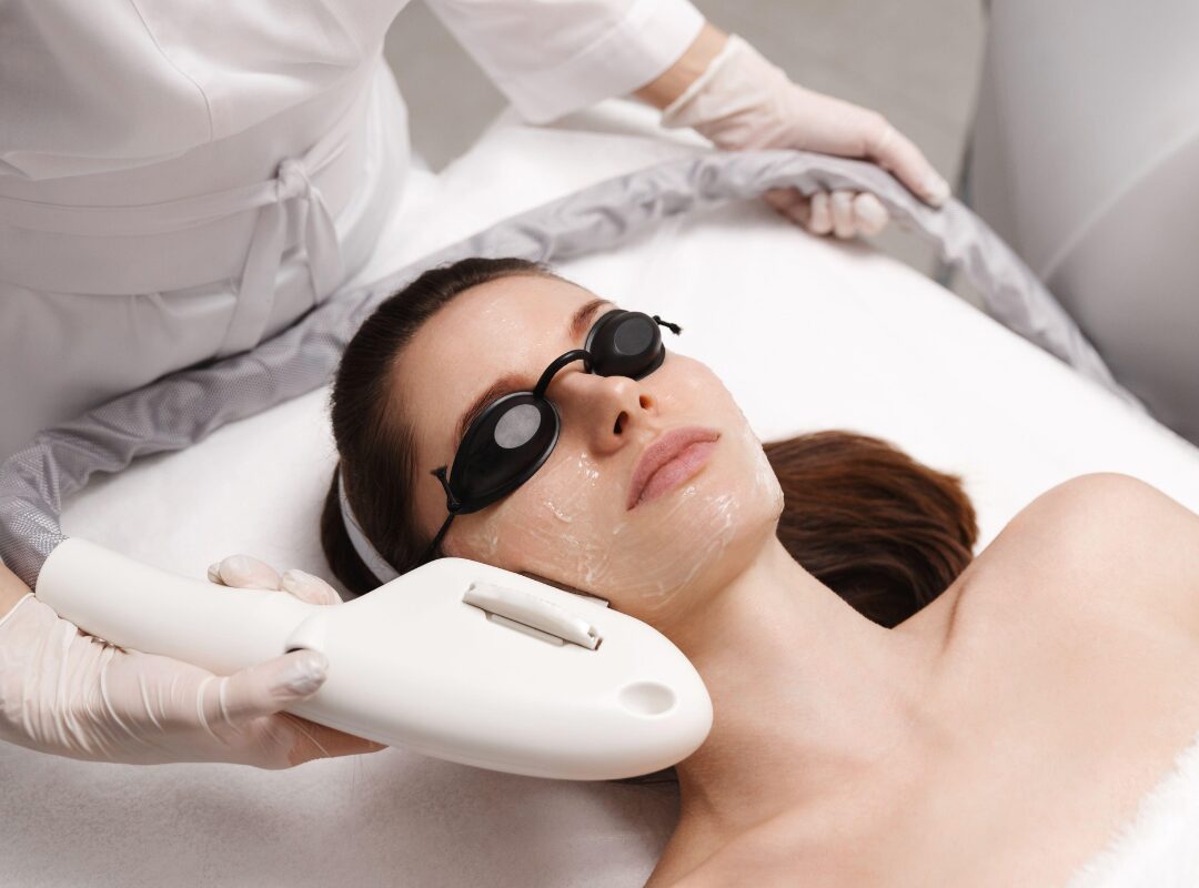 Recovery Timeline Of An IPL Photofacial
