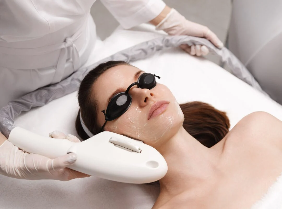 Recovery Timeline Of An IPL Photofacial
