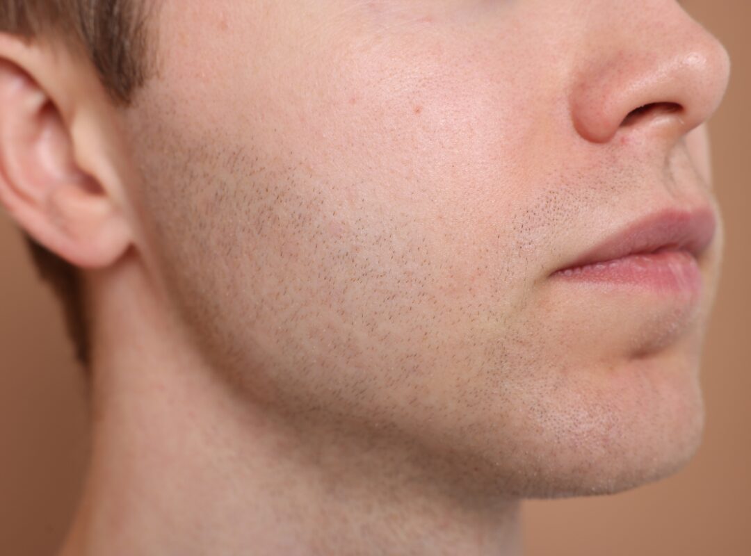 Hair Growth Treatments in Alamo