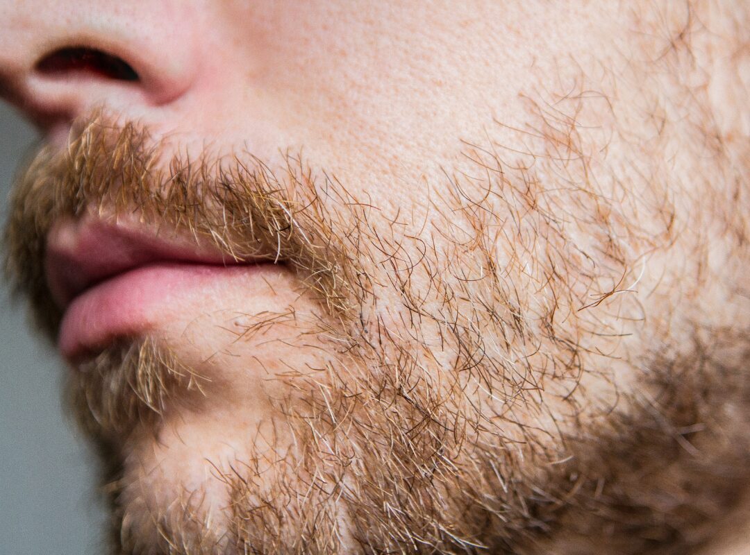 How Minoxidil Helps Facial Hair Growth