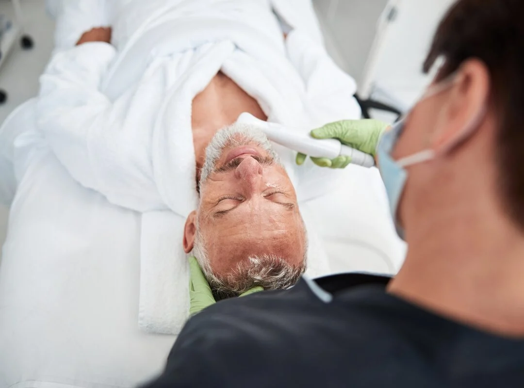IPL Photofacial Walnut Creek California