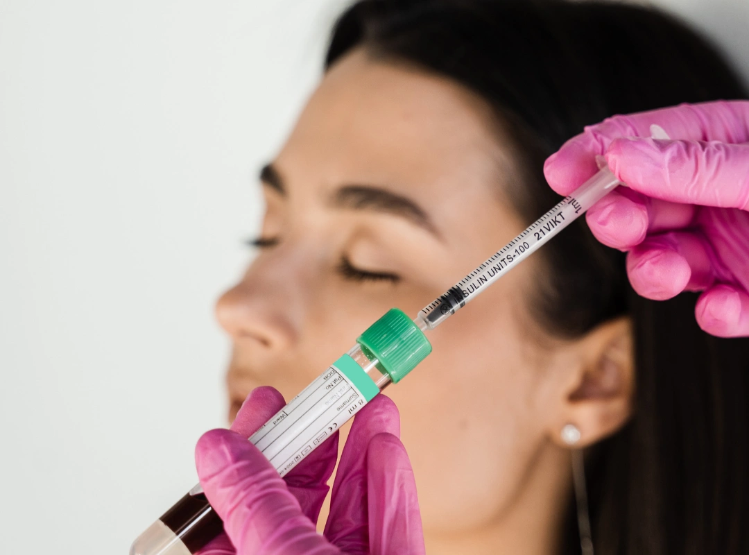 Is PRP Better Than Minoxidil