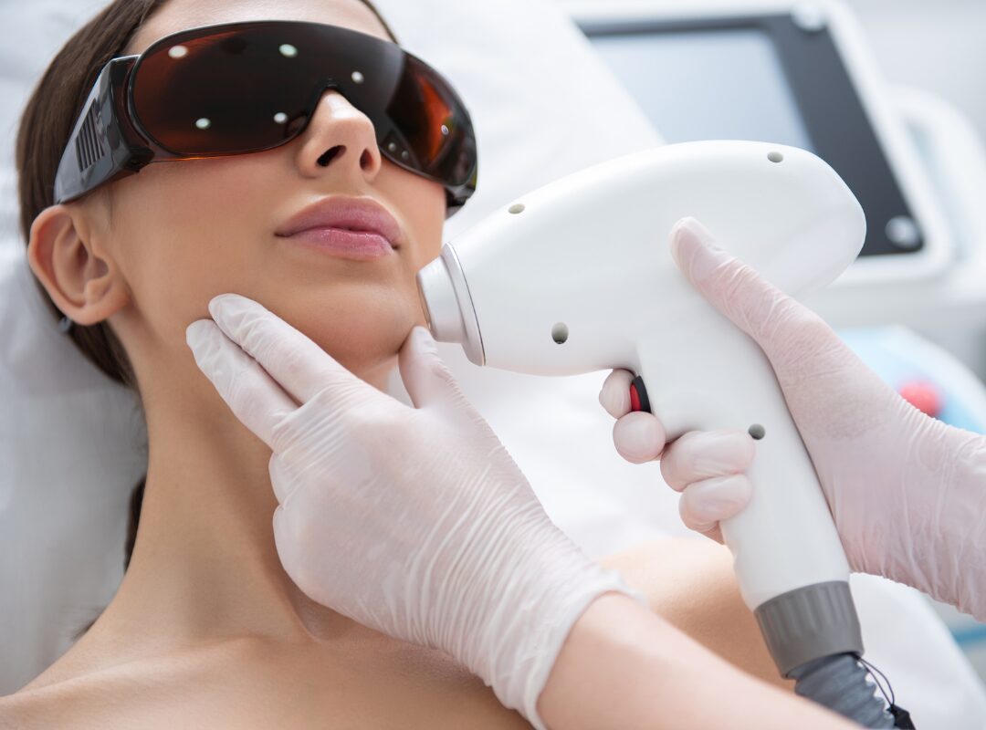Laser Hair Removal with HSV-2