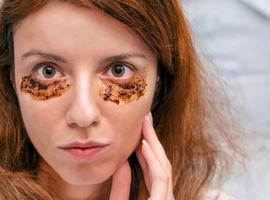 How To Remove Dark Circles Under Eyes Permanently Alamo