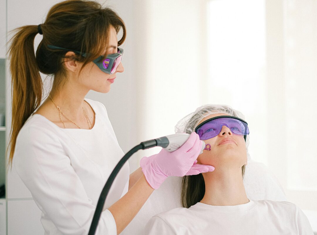 Electrolysis for PCOS Facial Hair