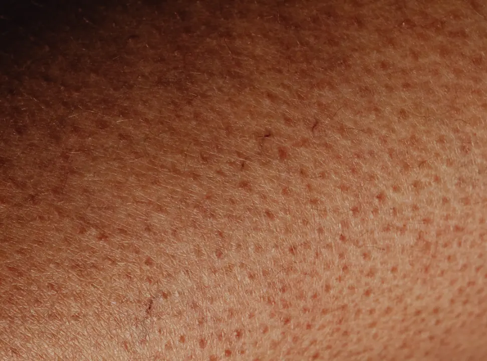 Pore Minimizing Treatments at Skin Artistry Clinic