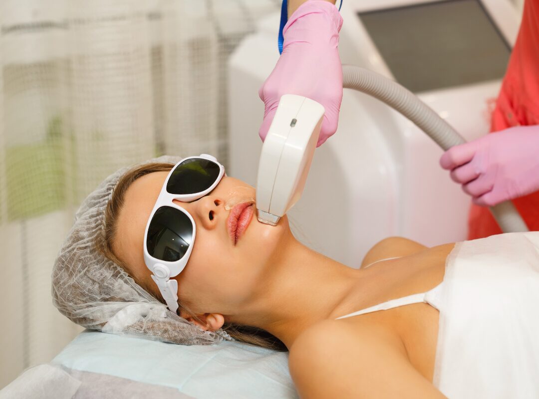 Electrolysis vs Laser Hair Removal for Women