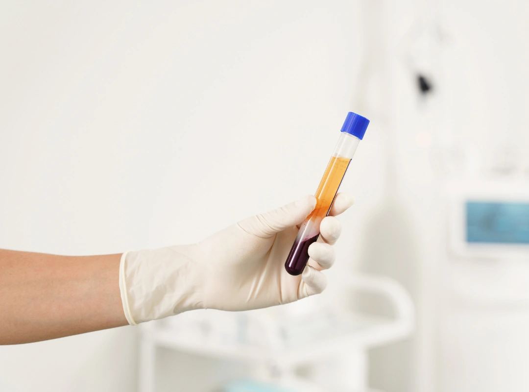 Skin Artistry Clinic PRP Therapy