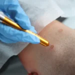 Skin Treatments at Skin Artistry Clinic