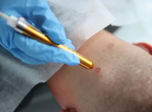 Skin Treatments at Skin Artistry Clinic