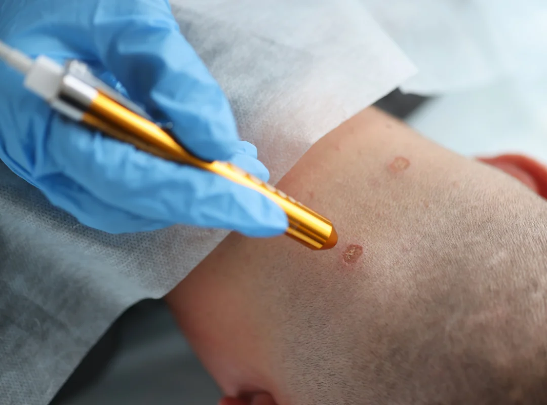 Skin Treatments at Skin Artistry Clinic