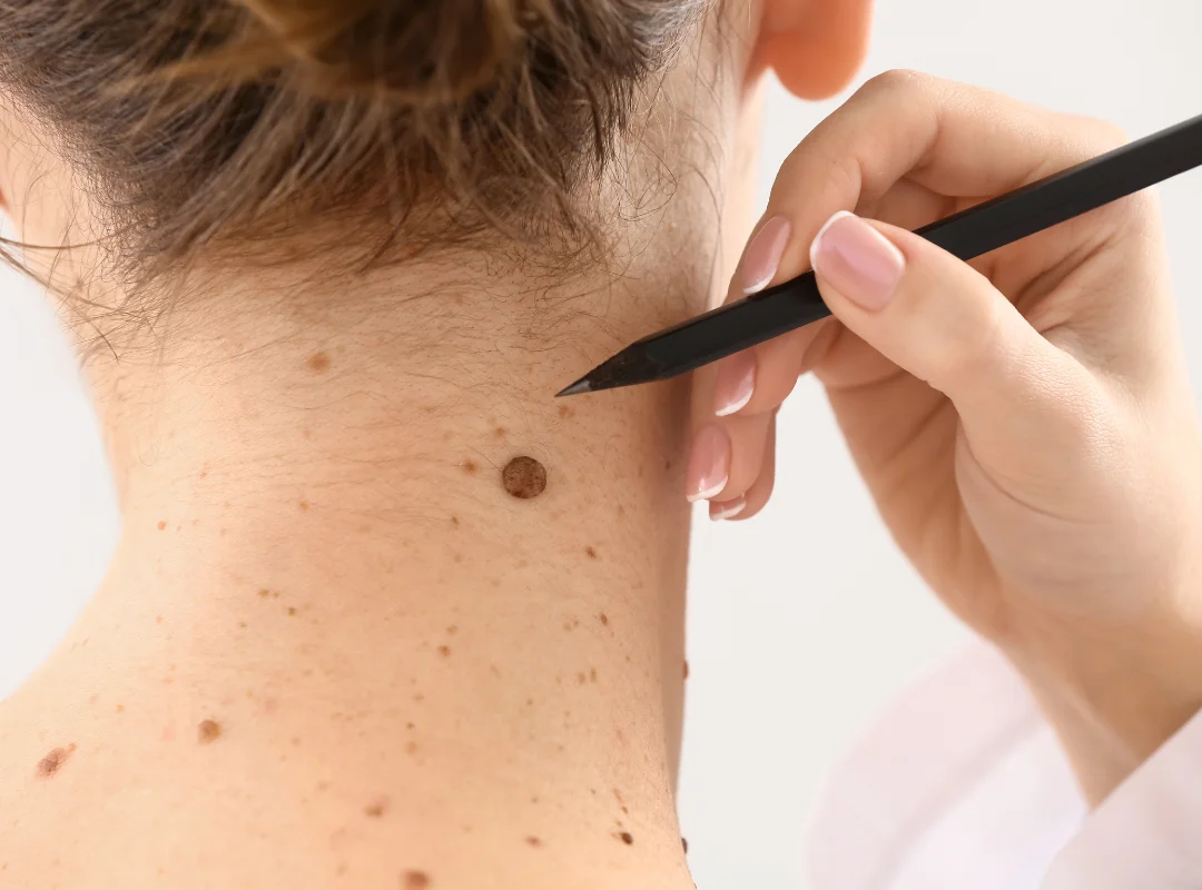 Best Skin Care Treatment in Alamo, CA