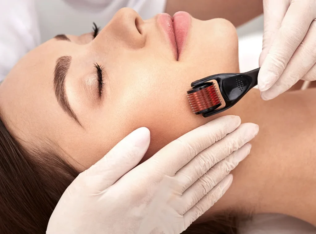 Derma Roller by Skin Artistry Clinic