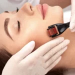 Derma Roller by Skin Artistry Clinic