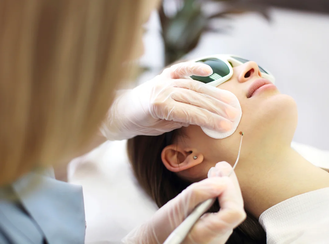 Does Laser Mole Removal Actually Work