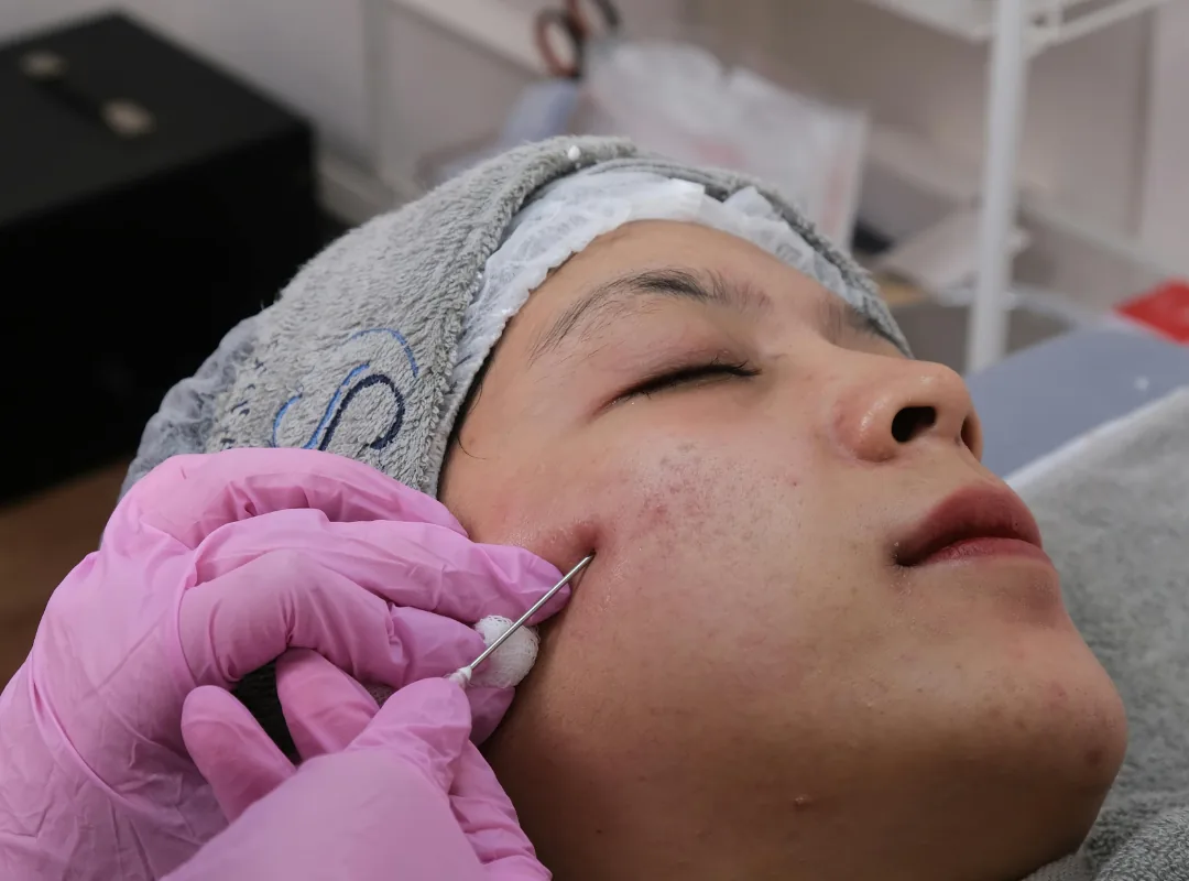 How Much Does PRP Cost