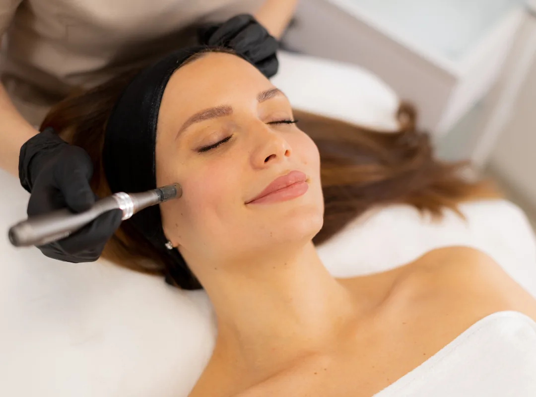 How Will I Look 2 Days After Microneedling