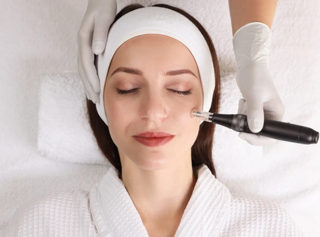 RF Microneedling For Skin Tightening
