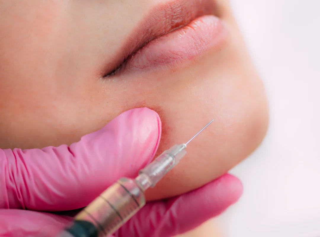 Can Chin Filler Improve Your Side Profile
