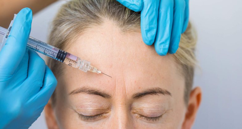 Botox for smoker’s lines